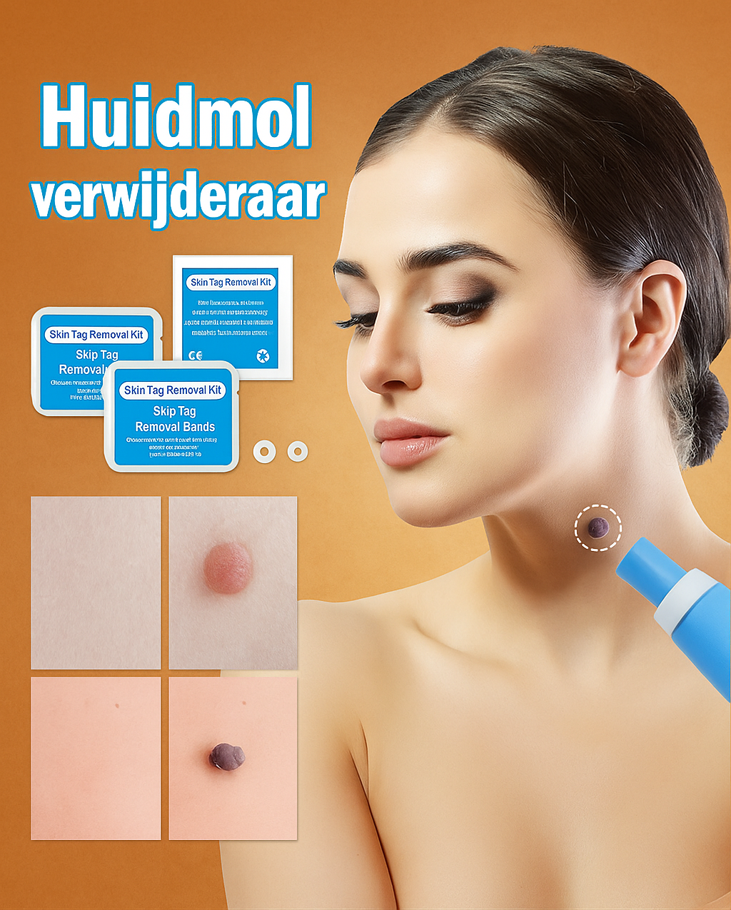 Huidmol Verwijderaar voor Thuisgebruik | Effectief en pijnloos in je eigen badkamer